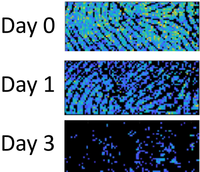 Levels of an unsaturated triacylglycerol decline in fingerprints from an individual from day 0 (top) to day 1 (middle) and day 3 (bottom). Credit: adapted from Analytical Chemistry 2020, doi: https://doi.org/10.1021/acs.analchem.9b04765