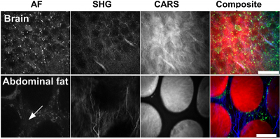 A typical overlay of different imaging methods. Graphic from J. Medical Imaging 2(1), 016003 (2015).