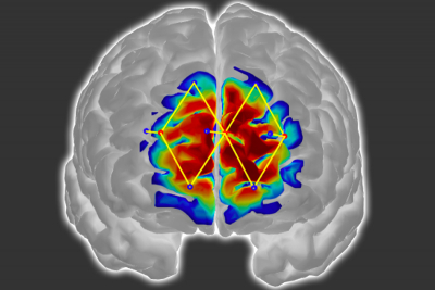 Researchers from MIT and elsewhere have developed a system that detects pain in patients with an fNIRS device, which could help doctors diagnose and treat pain in unconscious and non-communicative patients. Credit: Researchers and MIT