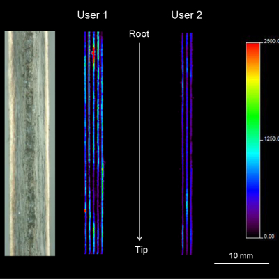 MALDI-MS/MS image of longitudinally sectioned drug users’ hair samples (insert shows optical image of longitudinally sectioned hair). The image shows the differential distribution (quantities and location) of the product ion at m/z 182, derived from the precursor ion of cocaine at m/z 304 within the hair shaft of two cocaine users. The length of the analysed hair samples was 4 cm corresponding to a hair growth period of 4 month. Since the spatial resolution along the hair is 150 μm, each pixel is equivalent to approximately 12 h of growth (adapted and reproduced from https://doi.org/10.1007/s13361-017-1766-0 under a Creative Commons BY Licence).