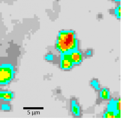 Raman image of Alzheimer brain tissue. Red is the core of the affected area. Light grey is healthy tissue, darker grey already shows a transition.