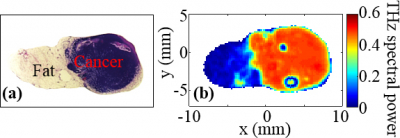 Pathology image, left, and corresponding terahertz image, right, of excised tissue from mouse breast tumour. Photo submitted by the researcher.