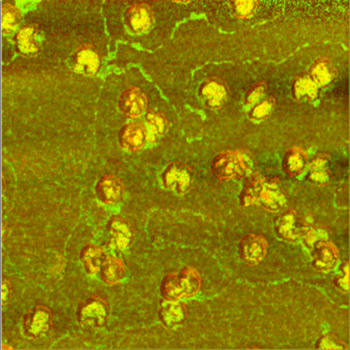 A composite image of herpes simplex virus particles, obtained by AFM-IR. Courtesy of Dmitry Kurouski