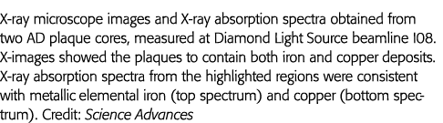 X-ray microscope images and X-ray absorption spectra obtained from two AD plaque cores, measured at Diamond Light Sou