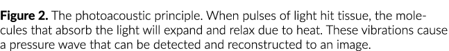 Figure 2  The photoacoustic principle  When pulses of light hit tissue, the molecules that absorb the light will expa
