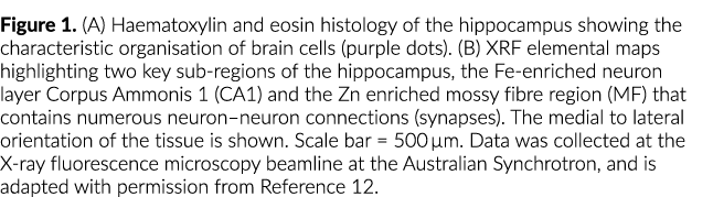 图1 (A)苏木精和伊红海马体的组织学特征组织的大脑ce