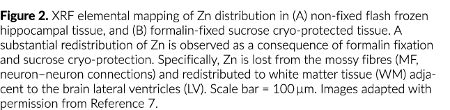 图2光谱仪元素的映射锌分布(一)固定期限flash冷冻海马组织,和(B)福尔马林