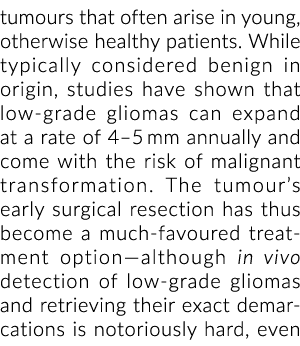 肿瘤通常出现在年轻,否则健康的病人。而通常被认为是良性的起源、研究h……